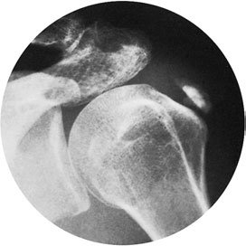Figura 6: Aspect radiografic / Poziționare (Clark Ed. 12)