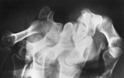Figura 3: Aspect radiografic / Poziționare (Clark Ed. 12)