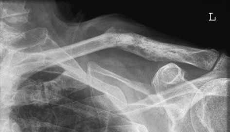 Figura 4: Aspect radiografic / Poziționare (Clark Ed. 12)