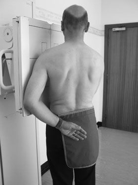 Spații articulare clare față de coloana vertebrală. Incidență oblică