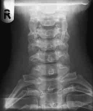 Figura 2: Aspect radiografic / Poziționare (Clark Ed. 12)