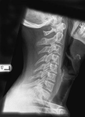 Figura 4: Aspect radiografic / Poziționare (Clark Ed. 12)
