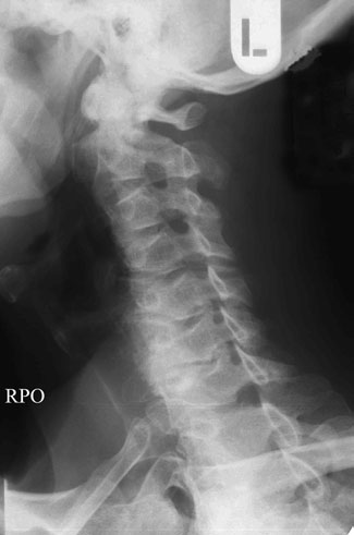 Figura 6: Aspect radiografic / Poziționare (Clark Ed. 12)