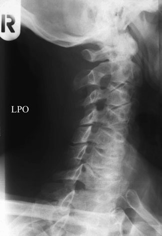 Figura 7: Aspect radiografic / Poziționare (Clark Ed. 12)