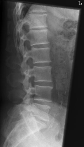 Figura 3: Aspect radiografic / Poziționare (Clark Ed. 12)