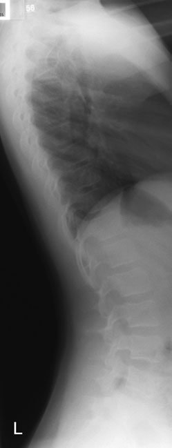 Figura 2: Aspect radiografic / Poziționare (Clark Ed. 12)