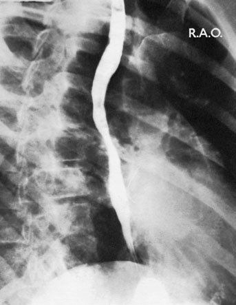 Poziție pentru incidența radiografică.