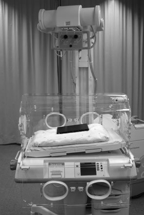 Descrierea completă a radiografiei neonatale este prezentată în Secțiunea 14.