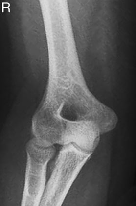 Figura 4: Aspect radiografic / Poziționare (Clark Ed. 12)