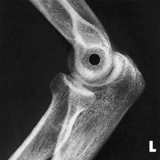 Figura 6: Aspect radiografic / Poziționare (Clark Ed. 12)