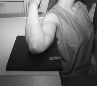 Radiografie a cotului evidențiind șanțul ulnar