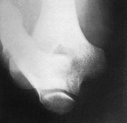 Figura 5: Aspect radiografic / Poziționare (Clark Ed. 12)