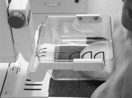 Mâna radiografului este retrasă, astfel încât compresia finală să poată