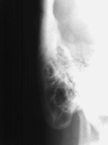 Figura 2: Aspect radiografic / Poziționare (Clark Ed. 12)