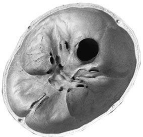Figura 2: Aspect radiografic / Poziționare (Clark Ed. 12)