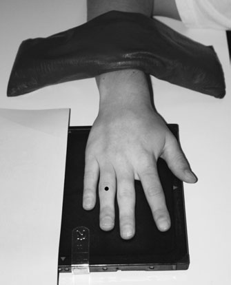 Radiografie postero-anterioară (PA) a degetului
