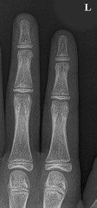 Radiografie de profil (laterală) a