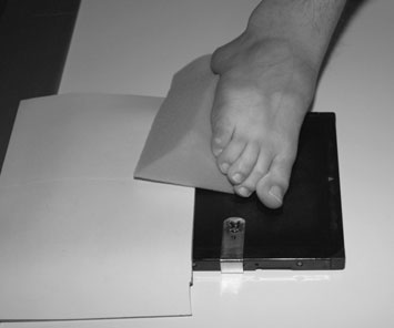 Incidență dorso-plantară normală a tuturor degetelor de la picior