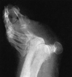 Figura 5: Aspect radiografic / Poziționare (Clark Ed. 12)