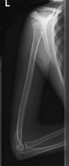 Radiografie de profil (lateral) normală a