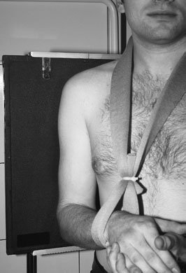 Radiografie anteroposterioară (AP)