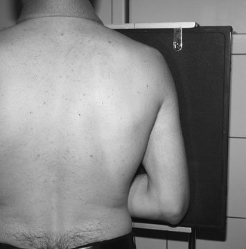 Radiografie de profil (lateral) a