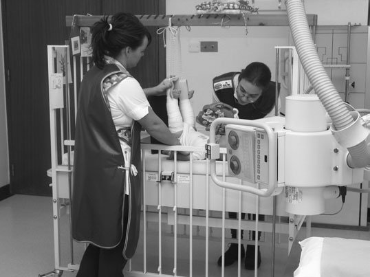 12 Fractură de femur — pediatrică