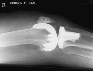 Figura 4: Aspect radiografic / Poziționare (Clark Ed. 12)