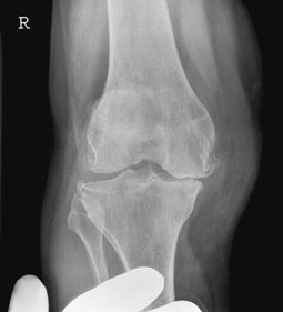 Figura 4: Aspect radiografic / Poziționare (Clark Ed. 12)