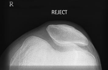 Figura 3: Aspect radiografic / Poziționare (Clark Ed. 12)