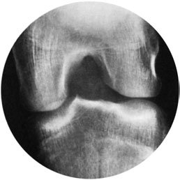 Figura 3: Aspect radiografic / Poziționare (Clark Ed. 12)