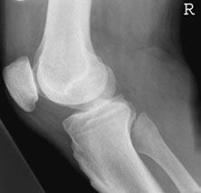 Figura 4: Aspect radiografic / Poziționare (Clark Ed. 12)