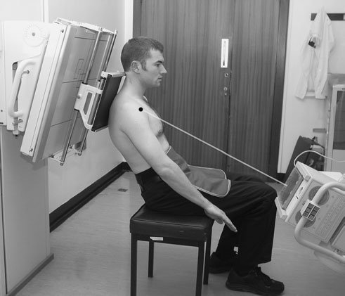 Radiografie a culisei bicipitale (șanțului intertubercular)