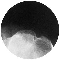 Figura 4: Aspect radiografic / Poziționare (Clark Ed. 12)
