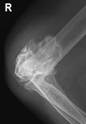 Figura 4: Aspect radiografic / Poziționare (Clark Ed. 12)