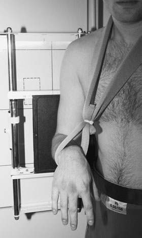 Radiografie anteroposterioară (AP) în