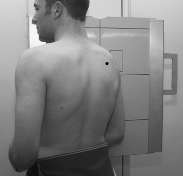 Figura 2: Aspect radiografic / Poziționare (Clark Ed. 12)