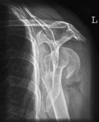 Figura 3: Aspect radiografic / Poziționare (Clark Ed. 12)