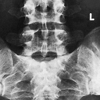 Figura 4: Aspect radiografic / Poziționare (Clark Ed. 12)