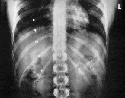 Figura 2: Aspect radiografic / Poziționare (Clark Ed. 12)