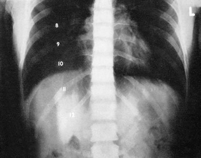 Figura 4: Aspect radiografic / Poziționare (Clark Ed. 12)