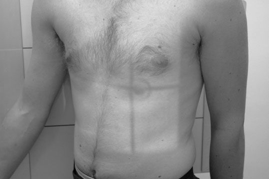 Figura 3: Aspect radiografic / Poziționare (Clark Ed. 12)