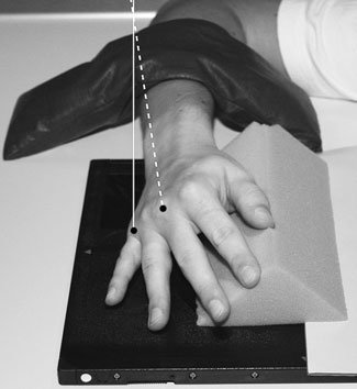 Radiografie oblică anterioară normală a mâinii stângi
