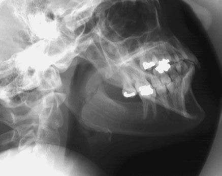 Figura 3: Aspect radiografic / Poziționare (Clark Ed. 12)