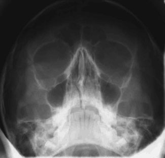 Figura 3: Aspect radiografic / Poziționare (Clark Ed. 12)