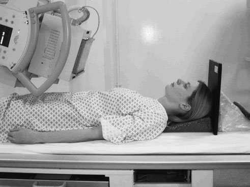 Figura 2: Aspect radiografic / Poziționare (Clark Ed. 12)