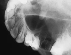 Figura 3: Aspect radiografic / Poziționare (Clark Ed. 12)