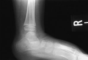 Figura 10: Aspect radiografic / Poziționare (Clark Ed. 12)