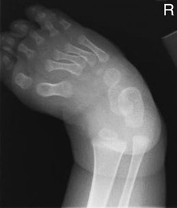 Figura 3: Aspect radiografic / Poziționare (Clark Ed. 12)