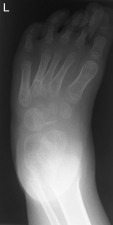 Figura 4: Aspect radiografic / Poziționare (Clark Ed. 12)
